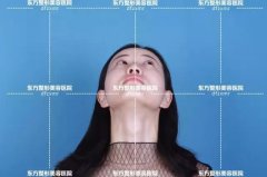 郑州东方整形线雕隆鼻,直播25岁女白领变女神！